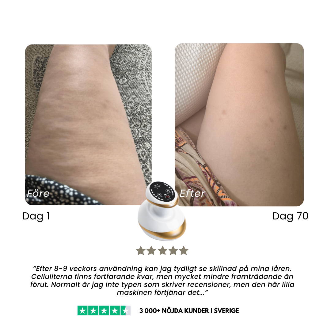 CelluSmooth™ – Cellulit massageapparat